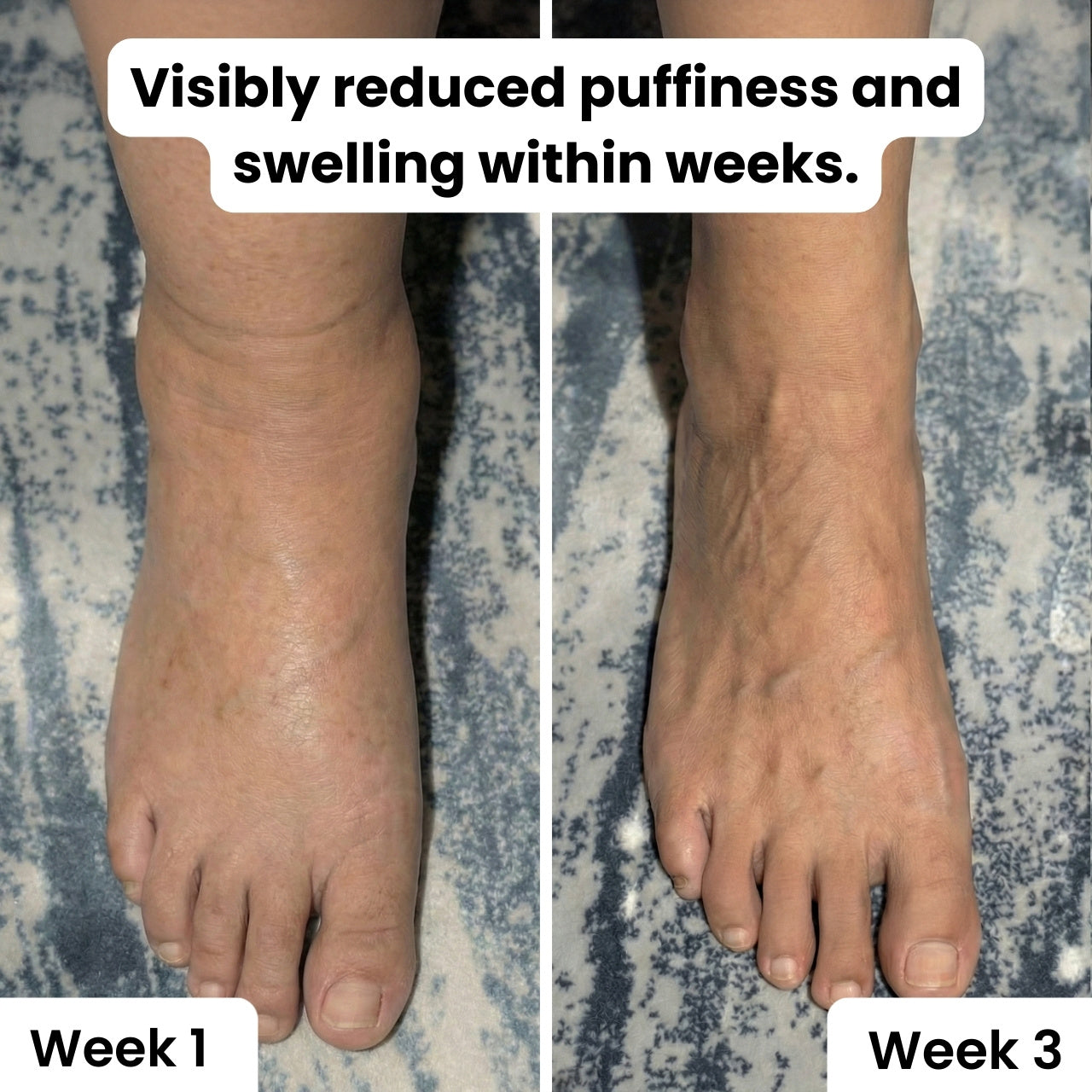 Daily Relief – Triple Therapy