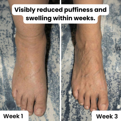 Daily Relief – Triple Therapy